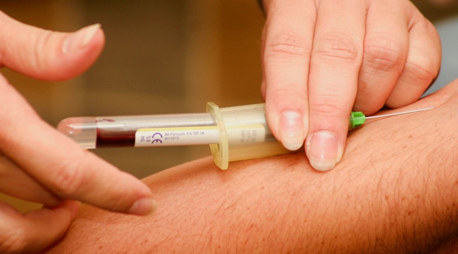 Bild: ACP/PRP Therapie, 