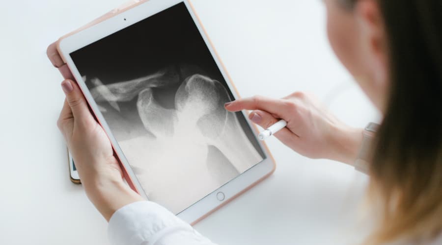 Bild: Arthroskopische Schulterchirurgie, 